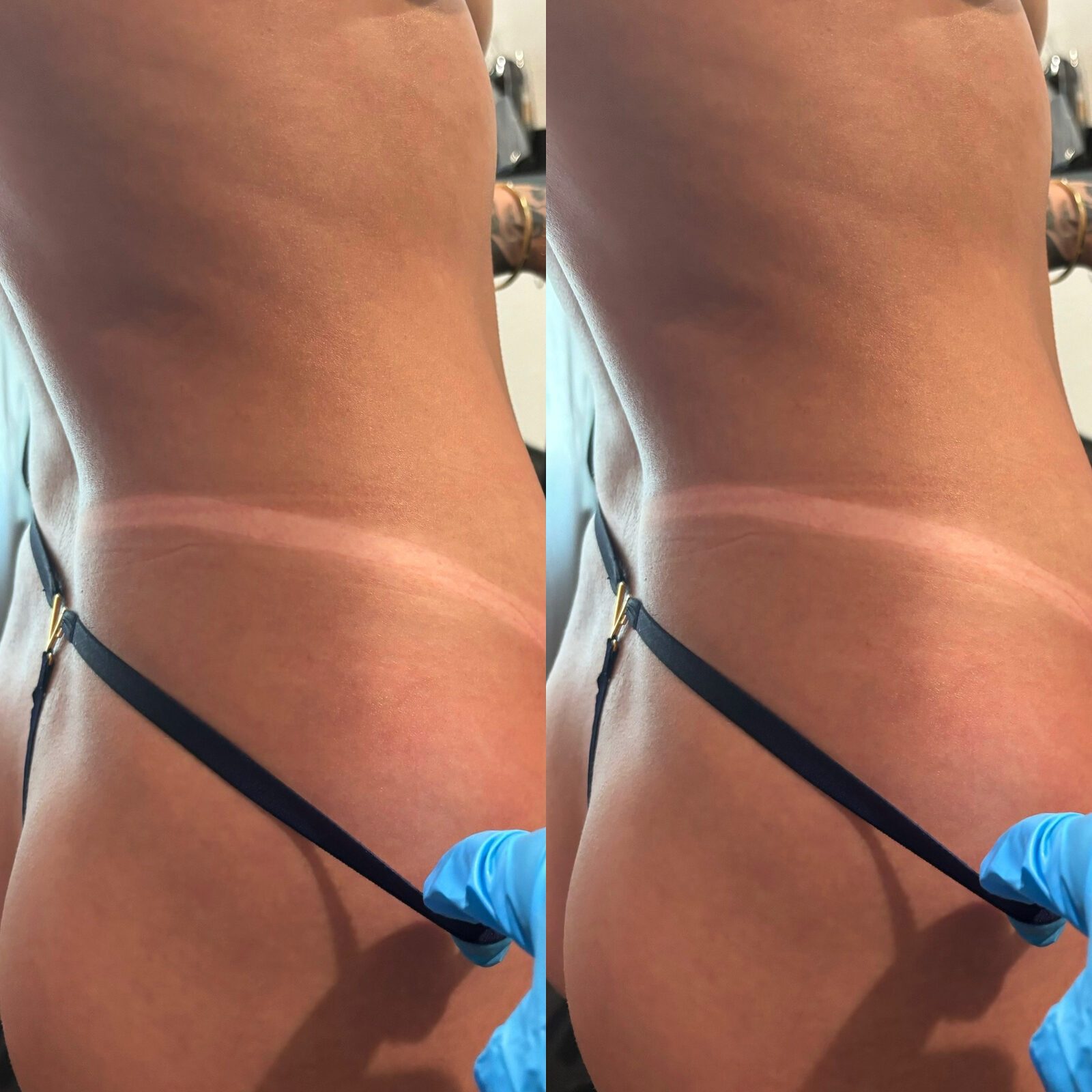 Spray tan torso before and after